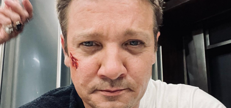 Jeremy Renner recebe alta e se recupera de acidente em casa