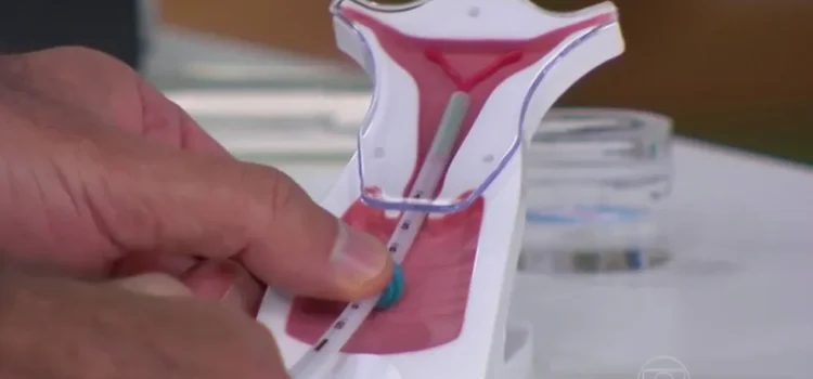 Mutirão oferece 300 vagas para inserção gratuita de DIU e anticoncepcionais injetáveis em Feira de Santana