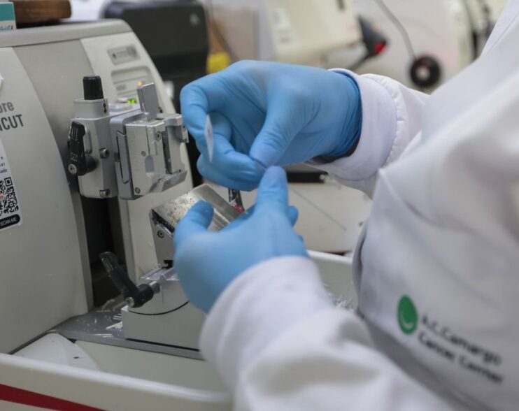 SUS anuncia nova terapia para adultos com leucemia mieloide; veja quem poderá receber